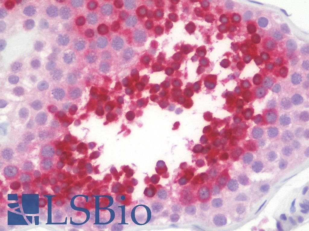 IHC-plus™ Polyclonal Rabbit anti-Human TSTA3 / GDP-L-Fucose Synthase Antibody (aa221-270, IHC, WB)