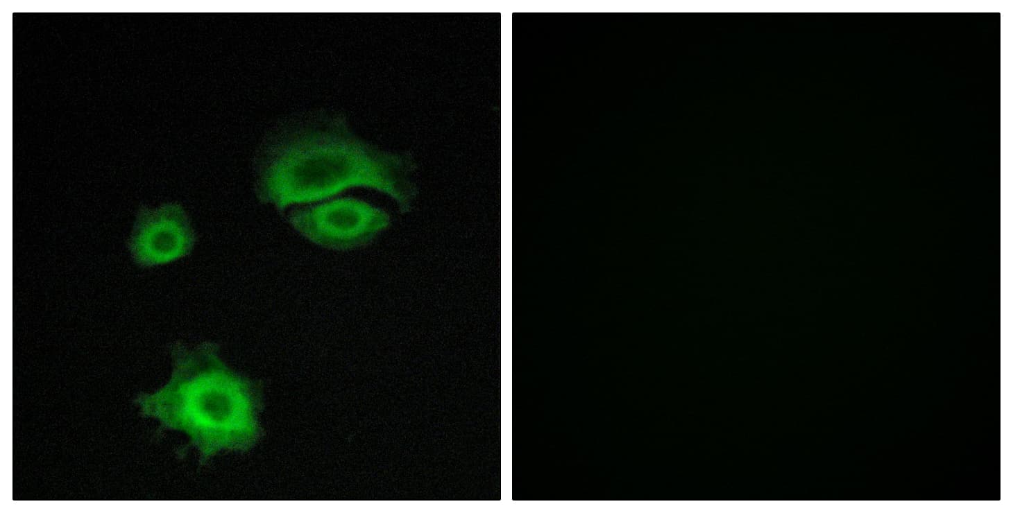 GRIA1 / GLUR1 Antibody (aa829-878)