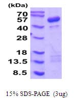 Human CYTH1 / Cytohesin-1 Protein (Recombinant His)