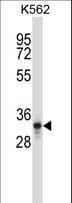 Polyclonal Rabbit anti-Human PTF1A Antibody (aa287-316, WB)