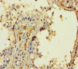 Polyclonal Rabbit anti-Human POMK / SGK196 Antibody