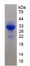 Human SIRPB1 / CD172b Protein (Recombinant His, N-Terminal)