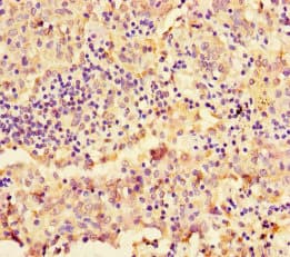 NAPSA / NAPA / Napsin A Antibody