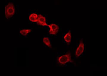 Polyclonal Rabbit anti-Human GUSB / Beta Glucuronidase Antibody (IF, WB)