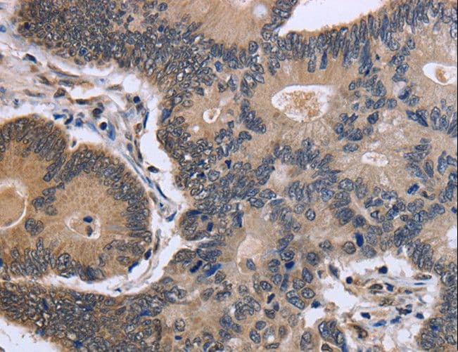Polyclonal Rabbit anti-Human FSTL1 Antibody (IHC)