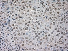 CTAG1B / NY-ESO-1 Antibody (clone OTI2B6)