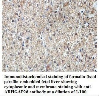 ARHGAP26 / GRAF Antibody (aa377-550)