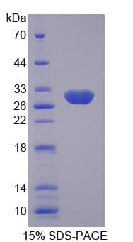 Human SCNN1G / ENaC Gamma Protein (Recombinant His-T7)
