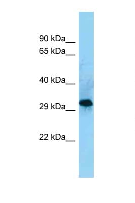 Polyclonal Rabbit anti-Human CD86 Antibody (aa203-252, WB)
