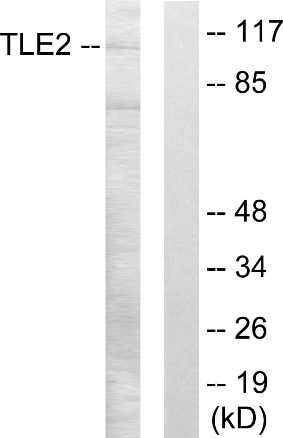 TLE2 Antibody (aa211-260)