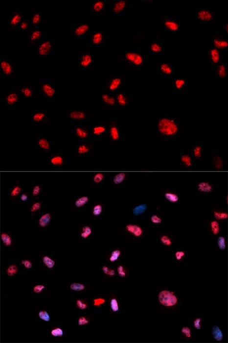 JUN / c-Jun Antibody (phospho-Thr239)