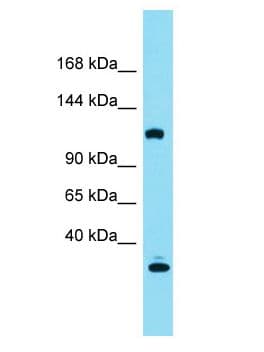 Polyclonal Rabbit anti-Human KIAA0355 Antibody (aa909-958, WB)