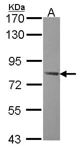 Polyclonal Rabbit anti-Human PRKAG2 / AMPK Gamma 2 Antibody (aa386-569, IHC, WB)