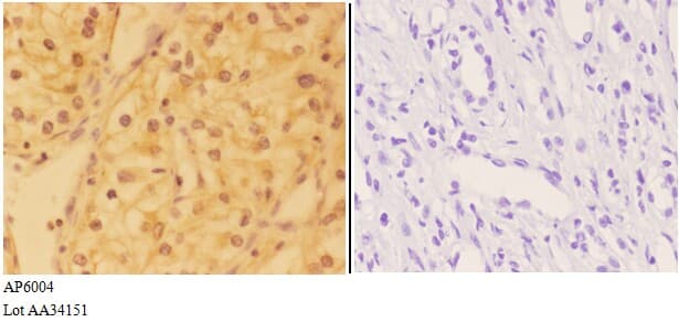 DHX36 Antibody