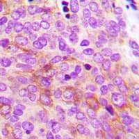 Polyclonal Rabbit anti-Human PRKAG2 / AMPK Gamma 2 Antibody (N-Terminus, IHC, IF, WB)