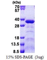 Human ACRP / SPAG7 Protein (Recombinant His)