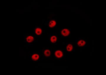 CREB1 / CREB Antibody (phospho-Ser133)