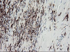F13A1 / Factor XIIIa Antibody (clone OTI3E3, Carrier-free)