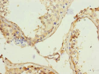 REC8 Antibody