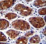 Polyclonal Rabbit anti-Human CPSF3L Antibody (aa91-119, IHC, IF, WB)