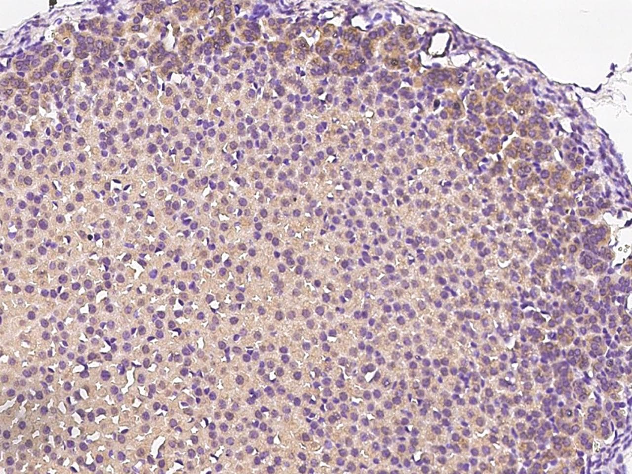 Polyclonal Rabbit anti-Human DDRGK1 Antibody (IHC)