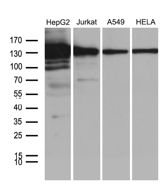 SIRT1 / Sirtuin 1 Antibody (aa552-676, clone OTI1H1)