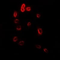 STOM / Stomatin Antibody