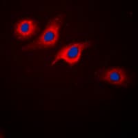 GLP1R / GLP-1 Receptor Antibody (Internal)