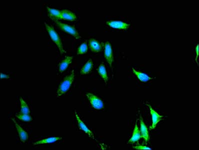 Polyclonal Rabbit anti-Human ITGAX / CD11c Antibody (IHC, IF, WB)