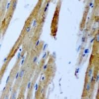 GNT-III / MGAT3 Antibody