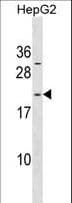 ARL6IP1 / ARMER Antibody (aa1-30)