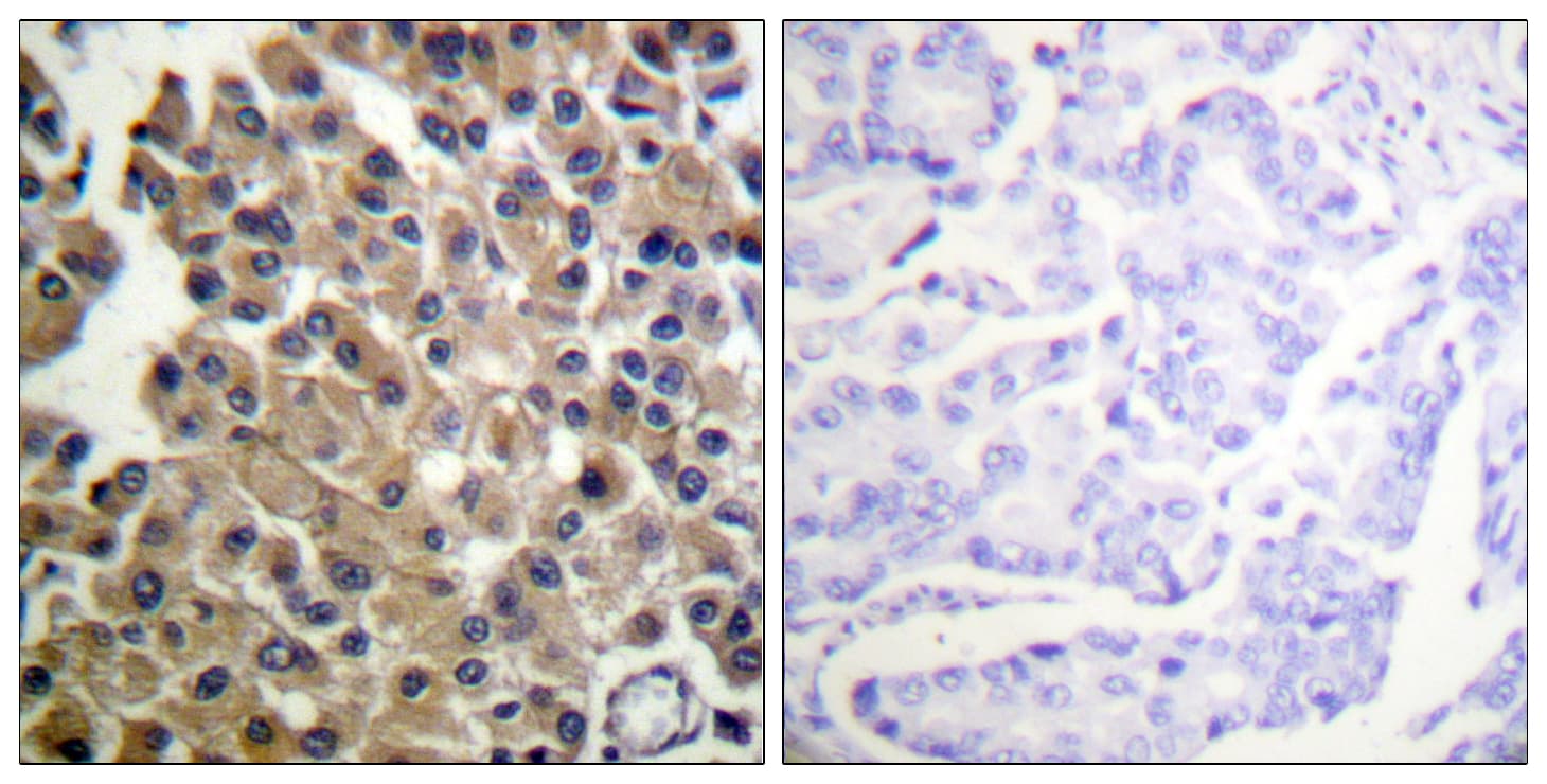 Polyclonal Rabbit anti-Human PDGFRB / PDGFR Beta Antibody (aa981-1030, IHC, IF)