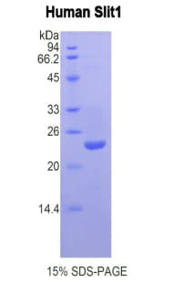 Human SLIT1 Protein (Recombinant His)