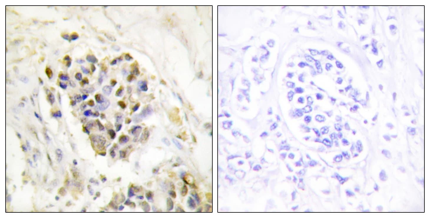 MED1 / TRAP220 Antibody (aa641-690)