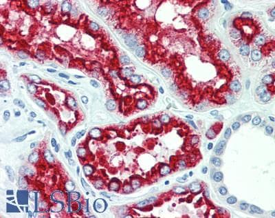 Polyclonal Rabbit anti-Human LRP2 / Megalin Antibody (aa4035-4184, IHC, WB)