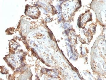 hCG / Chorionic Gonadotropin Antibody (clone HCGab/52, Ready-to-Use)