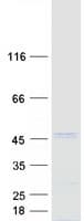 Human SPOP Protein (Recombinant Myc-DDK (Flag))