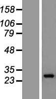 GS28 / GOSR1 / p28 Protein (Over-Expression Lysate Myc-DDK (Flag))