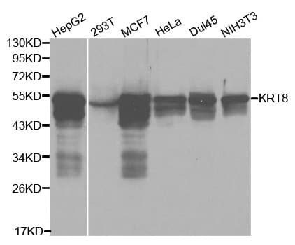 KRT8 / CK8 / Cytokeratin 8 Antibody