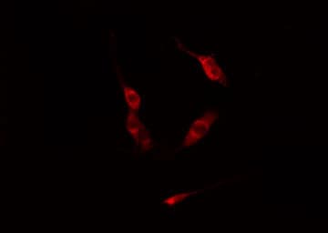 Polyclonal Rabbit anti-Human PKN1 Antibody (IF, WB)