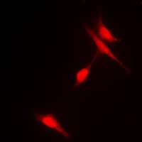 HDAC6 Antibody (N-Terminus)