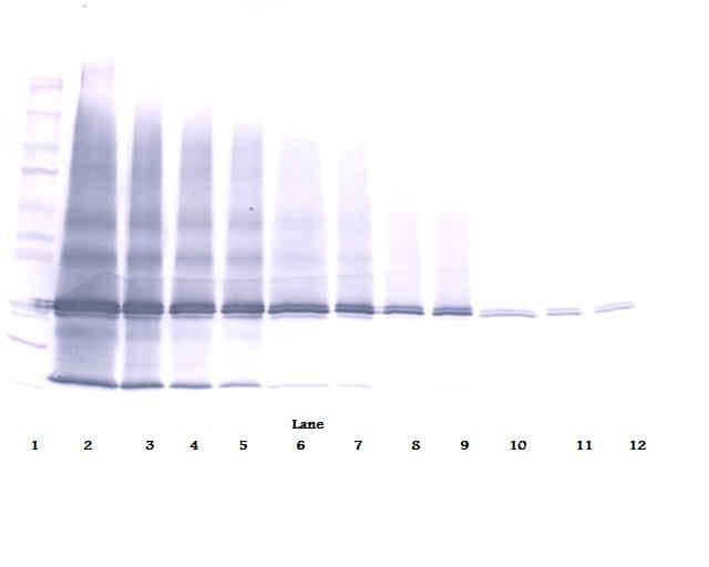 IL25 / IL17E Antibody