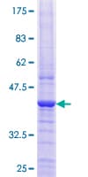 Human B9D1 Protein (Recombinant GST)