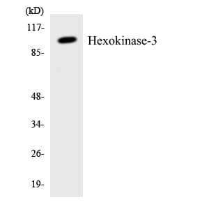 IHC-plus™ Polyclonal Rabbit anti-Human HK3 / Hexokinase 3 Antibody (aa799-848, IHC, WB)