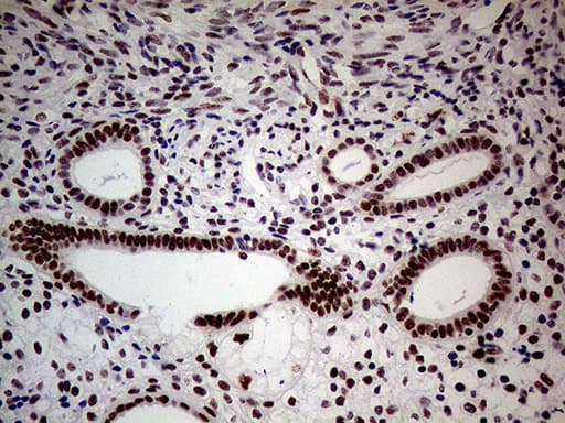 NSD3 / WHSC1L1 Antibody (aa427-566, clone OTI3B3)