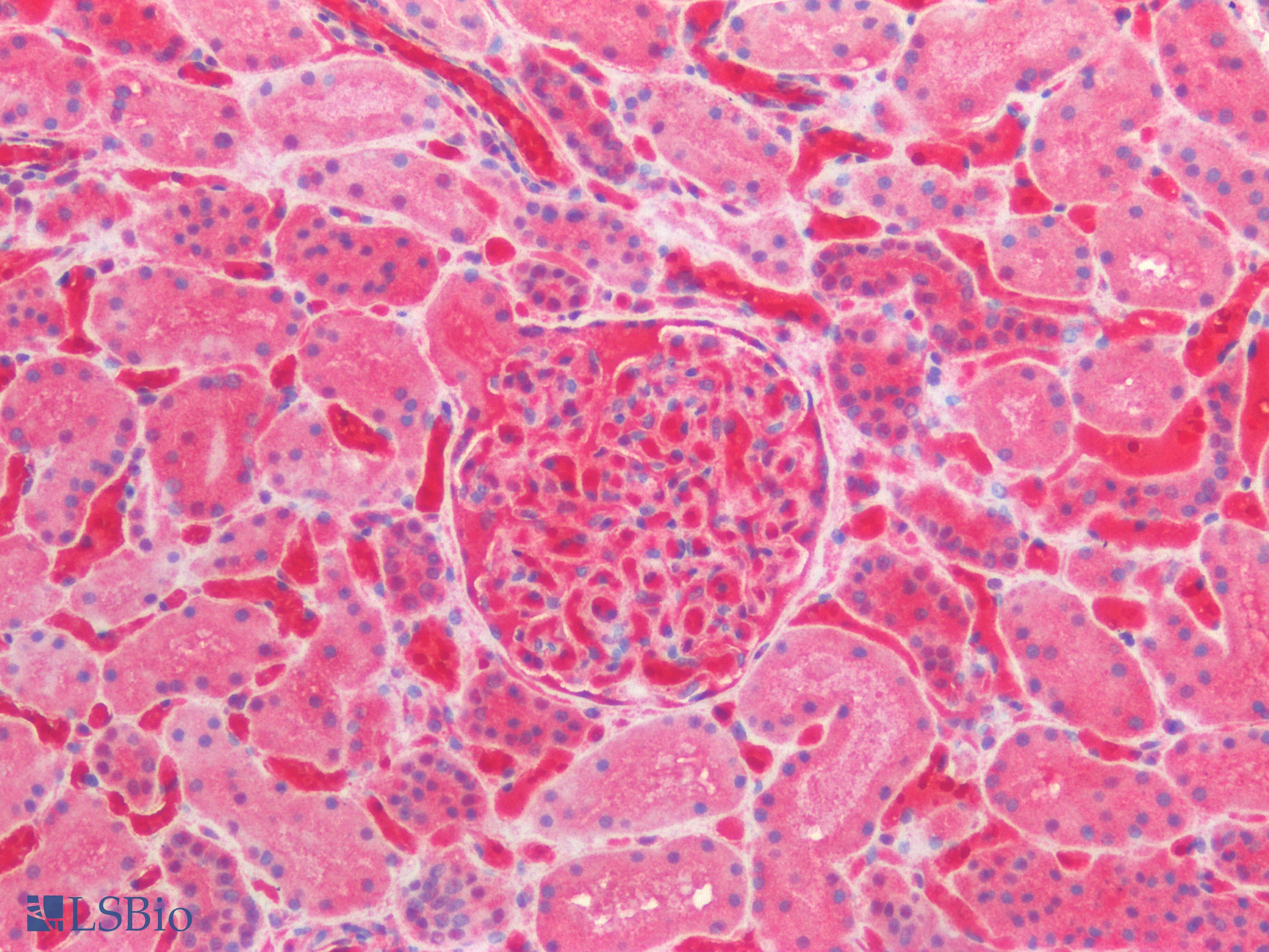 IHC-plus™ HBA2 / Hemoglobin Alpha 2 Antibody