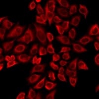 TTBK2 Antibody