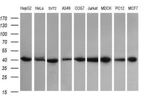 Monoclonal Mouse anti-Human ACAA2 Antibody (clone OTI2F6, IHC, IF, WB)