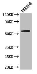 MLYCD / MCD Antibody