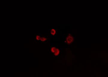 ZNF191 / ZNF24 Antibody